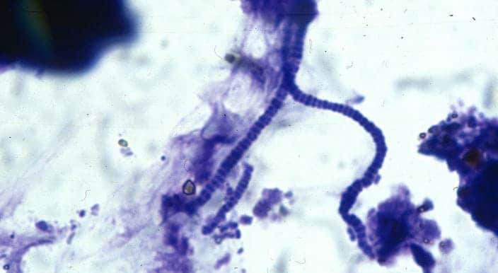 Dermatophilus congolensis, the bacteria that causes rain scald (Image courtesy APIAM).