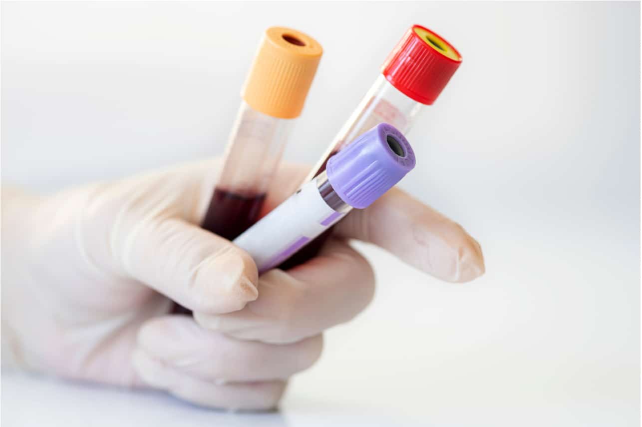 Blood test